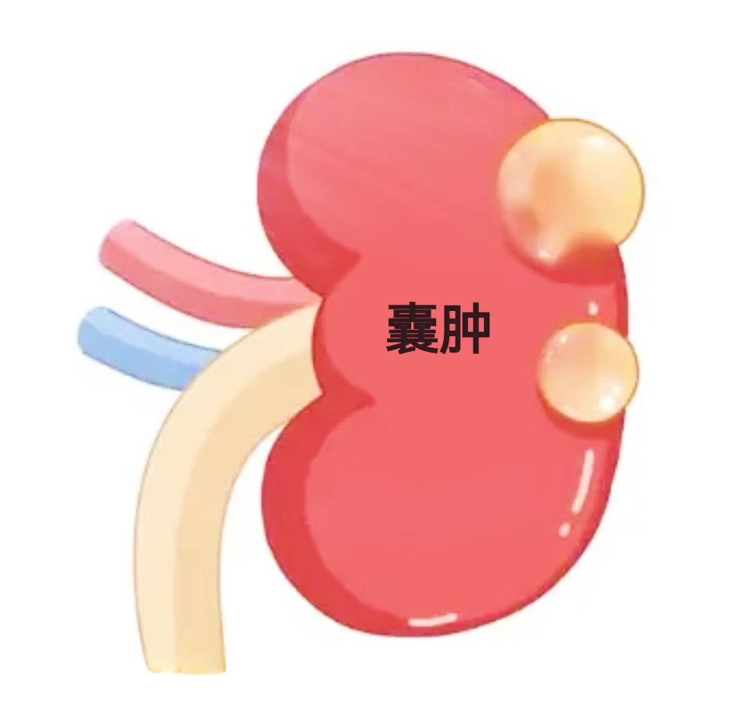 肾囊肿会自己消失吗？